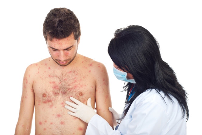 know-your-skin-rash-causes-and-solutions